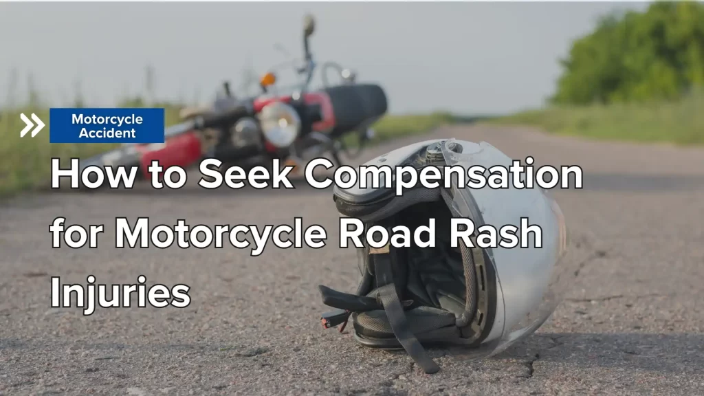 How to Seek Compensation for Motorcycle Road Rash Injuries Image